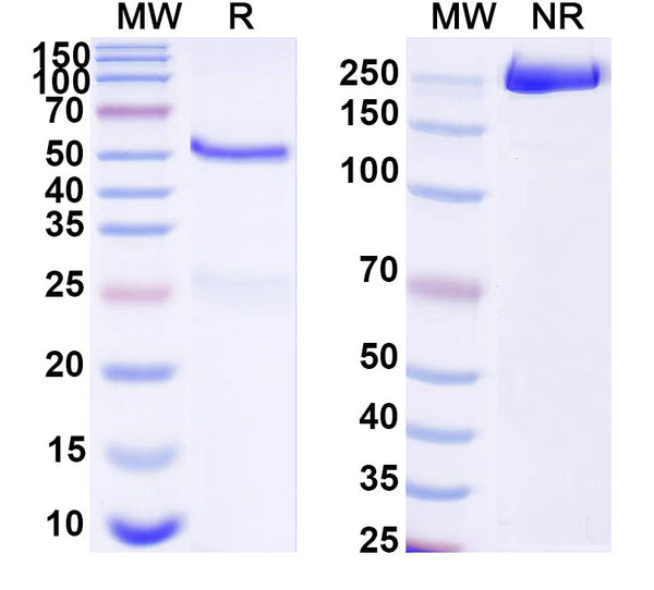 SDS-PAGE for Anti-Human FLT1 Monoclonal Antibody (1A116)