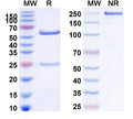 SDS-PAGE for Anti-Human FLT1 Monoclonal Antibody (1A119)