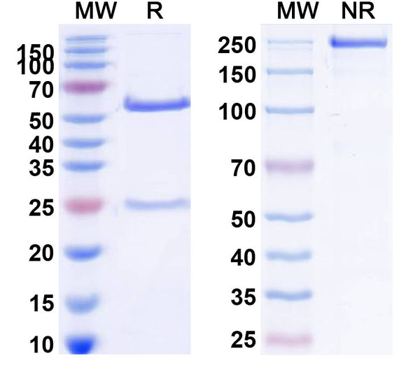 SDS-PAGE for Anti-Human FLT1 Monoclonal Antibody (1A119)