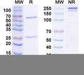 SDS-PAGE for Anti-Human FLT1/VEGFR1 Monoclonal Antibody (1A418)