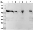 Western blot analysis was performed using anti-CAPN2 polyclonal antibody at 1ug/mL on various samples.
Lane 1: MDA-MB-231 cell lysate
Lane 2: A549 cell lysate
Lane 3: K562 cell lysate
Lane 4: C2C12 cell lysate
Lane 5: PC-3 cell lysate
Lane 6: PC-12 cell lysate
Lane 7: U2OS cell lysate