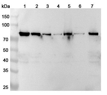 Western blot analysis was performed using anti-CAPN2 polyclonal antibody at 1ug/mL on various samples.
Lane 1: MDA-MB-231 cell lysate
Lane 2: A549 cell lysate
Lane 3: K562 cell lysate
Lane 4: C2C12 cell lysate
Lane 5: PC-3 cell lysate
Lane 6: PC-12 cell lysate
Lane 7: U2OS cell lysate