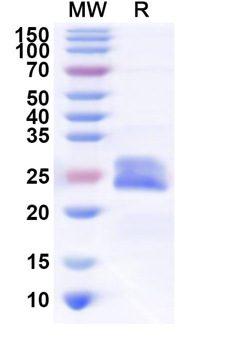 Recombinant Human TMEM201 Protein, N-His