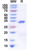 Recombinant Human HP1BP3 Protein, N-His