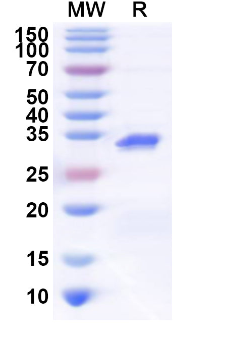 Recombinant Human HP1BP3 Protein, N-His