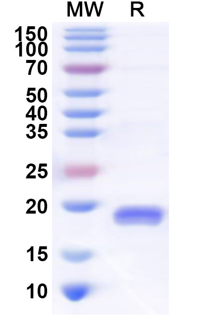 Recombinant Human LDLRAP1 Protein, N-His
