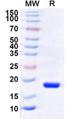 Recombinant Human BRMS1L Protein, N-His