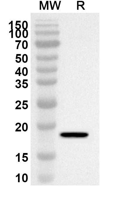 Western blot analysis was performed using anti-BRMS1L polyclonal antibody at 1ug/mL on recombinant BRMS1L (Catalog No. HB296012).