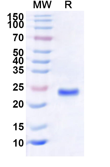Recombinant Human RTP2 Protein, N-His