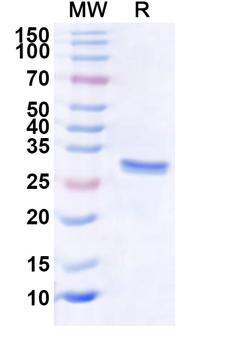 Recombinant Human EXOSC6 Protein, N-His