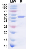 Recombinant Human DDX59 Protein, N-His