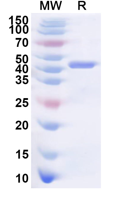 Recombinant Human DDX59 Protein, N-His