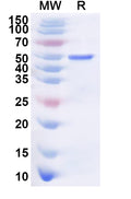Recombinant Human CDKAL1 Protein, N-His