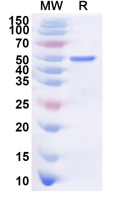 Recombinant Human CDKAL1 Protein, N-His