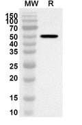 Western blot analysis was performed using anti-CDKAL1 polyclonal antibody at 1ug/mL on recombinant CDKAL1 (Catalog No. HB302012).