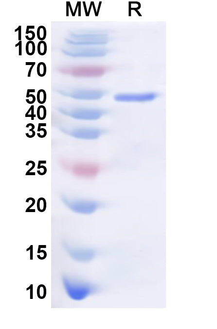 Recombinant Human STRIP1 Protein, N-His