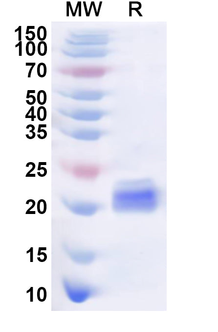 Recombinant Human GFI1B Protein, N-His