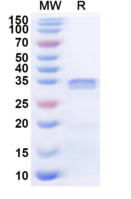 Recombinant Human MAP3K21 Protein, N-His