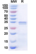 Recombinant Human NTMT2 Protein, N-His