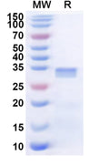 Recombinant Human CDC42BPG Protein, N-His