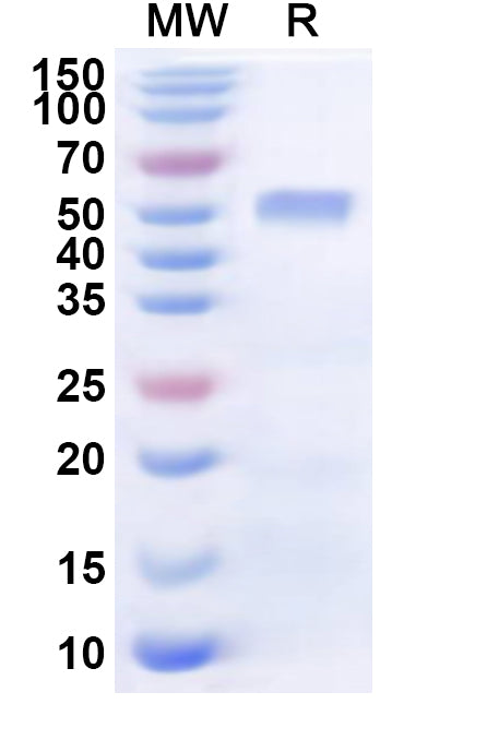 Recombinant Human SEMA3B Protein, N-His
