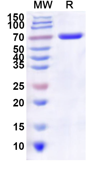 Recombinant Human ATP11A Protein, N-His
