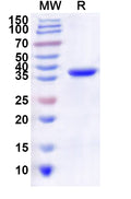 Recombinant Human CDK3 Protein, N-His