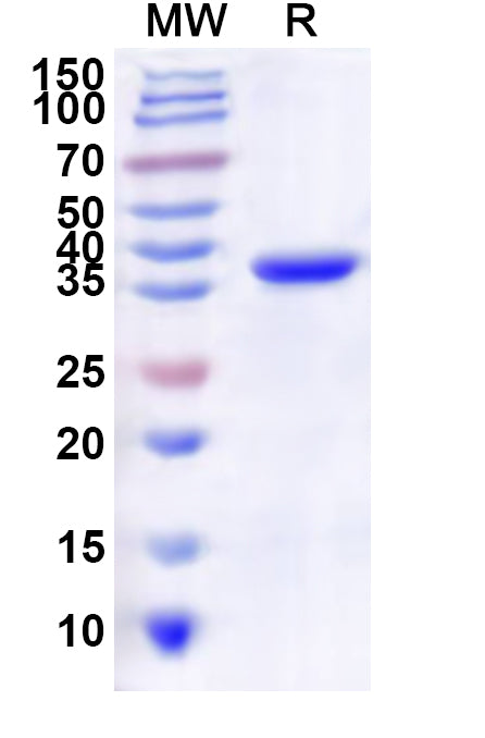 Recombinant Human CDK3 Protein, N-His