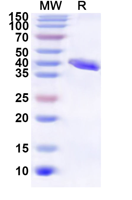 Recombinant Human RPL26 Protein, N-GST & C-His