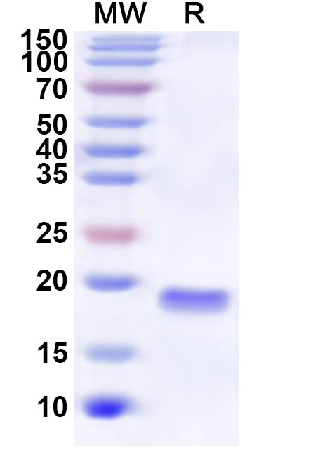 Recombinant Human FLOT2 Protein, N-His