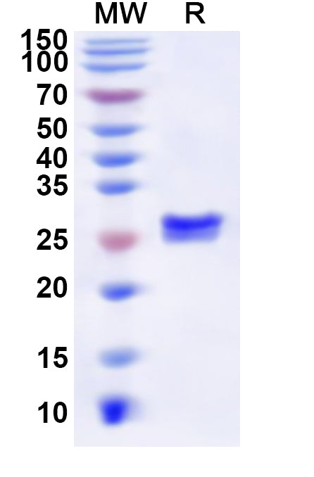 Recombinant Human HNRNPF Protein, N-His