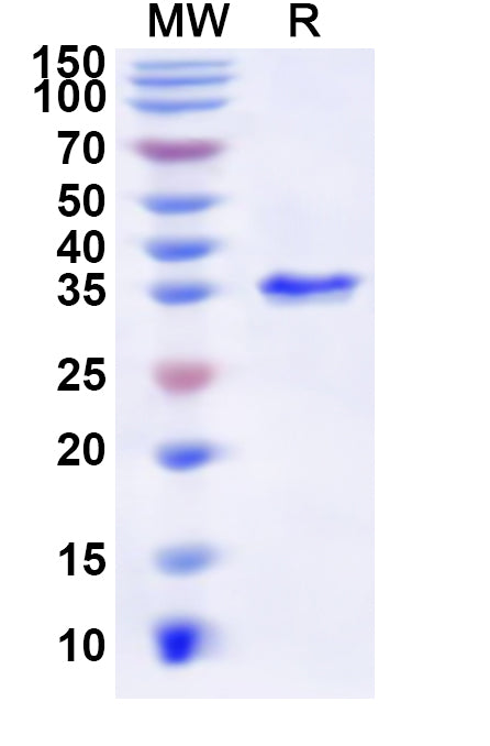 Recombinant Human SUB1 Protein, N-GST & C-His