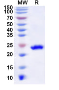 Recombinant Human CABP4 Protein, N-His