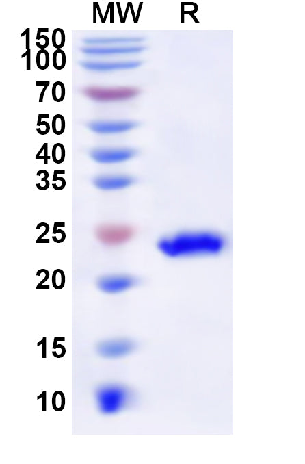 Recombinant Human CABP4 Protein, N-His