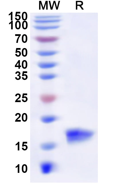 Recombinant Human MTPN Protein, N-His