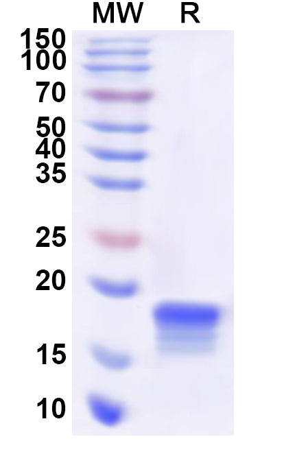 Recombinant Human RGS8 Protein, N-His