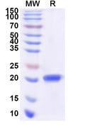 Recombinant Human NCS1 Protein, N-His