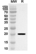 Western blot analysis was performed using anti-NCS1 polyclonal antibody at 1ug/mL on recombinant NCS1 (Catalog No. HB322012).