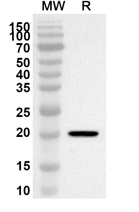 Western blot analysis was performed using anti-NCS1 polyclonal antibody at 1ug/mL on recombinant NCS1 (Catalog No. HB322012).