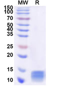 Recombinant Human PCBD1 Protein, N-His