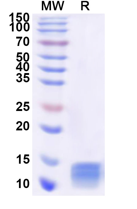 Recombinant Human PCBD1 Protein, N-His