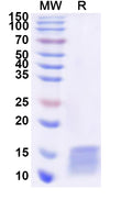 Recombinant Human POLR2J Protein, N-His