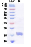 Recombinant Human CD300H Protein, N-His
