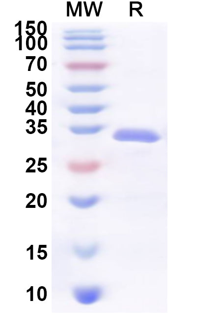Recombinant Human TANGO2 Protein, N-His