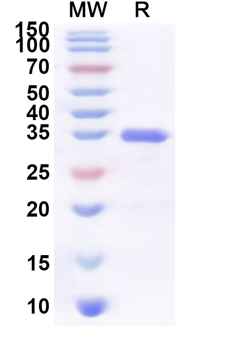 Recombinant Human SULT1C3 Protein, N-His