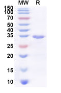 Recombinant Human USP43 Protein, N-His