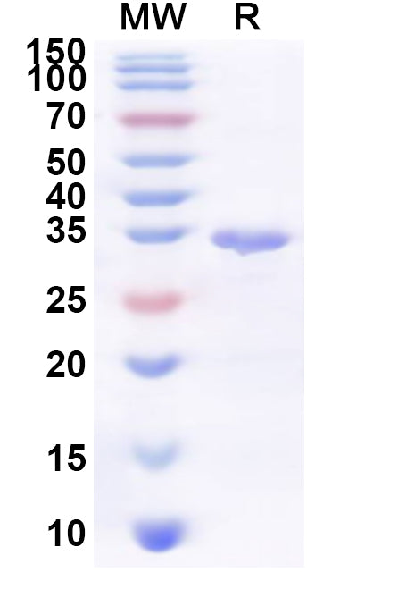 Recombinant Human USP43 Protein, N-His