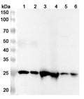 Western blot analysis was performed using anti-FAHD1 polyclonal antibody at 1ug/mL on various samples.
Lane 1: 293T cell lysate
Lane 2: Jurkat cell lysate
Lane 3: Mouse kidney lysate
Lane 4: Rat kidney lysate
Lane 5: Mouse liver lysate
Lane 6: Rat liver lysate