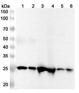 Western blot analysis was performed using anti-FAHD1 polyclonal antibody at 1ug/mL on various samples.
Lane 1: 293T cell lysate
Lane 2: Jurkat cell lysate
Lane 3: Mouse kidney lysate
Lane 4: Rat kidney lysate
Lane 5: Mouse liver lysate
Lane 6: Rat liver lysate