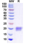 Recombinant Human UBE2H Protein, N-His